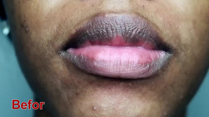 Lip Balm For Dark Lips Dry And Cracked Lips, Effectively Exfoliate, Mildly Moisturizes Lip Care Lip Primer, suitable For Men And Women - U&MORE